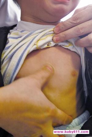 �㰴����Ѩ��