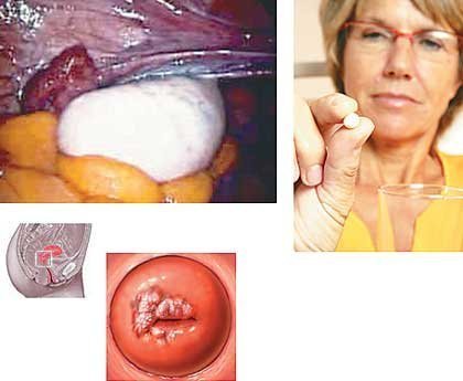 ���赼�²��еĶ��ֳ�����