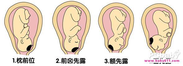 ͷ��¶����