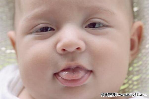 婴儿舌苔厚白是怎么回事?
