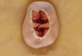 ��̥��ʱ̥����ʲô�о�