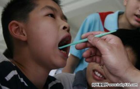 换牙期口腔保健好 孩子才能有副好牙齿