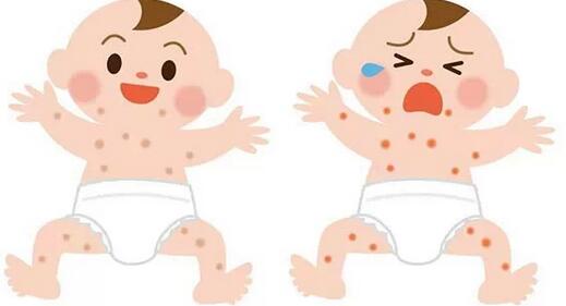 婴幼儿湿疹治疗的认识误区 - 婴儿湿疹