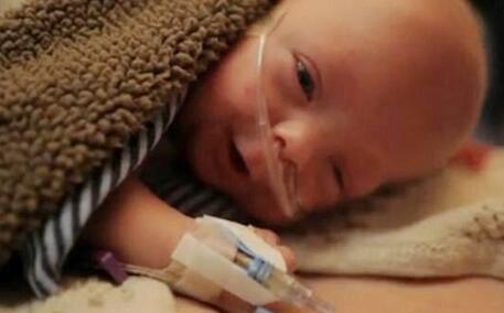 早产儿盲目喂养反而会肥胖