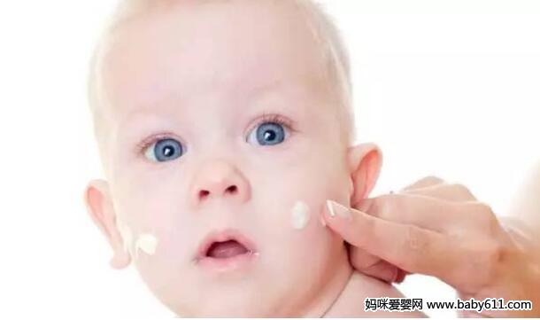 宝宝湿疹反复,试过那么多方法,这四点最靠谱