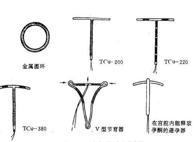 避孕环可以保存多久 放置避孕环最佳时间