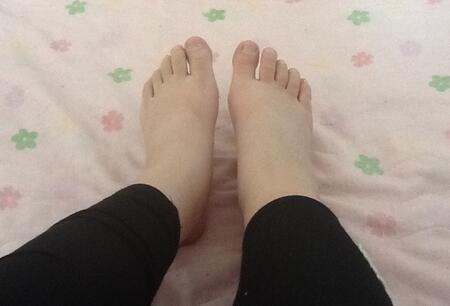 孕晚期脚肿了如何缓解