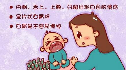 鹅口疮有什么症状呢?家长应如何护理