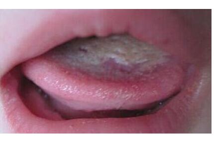 ��ڴ�������ʲô�����Ԥ�������ƣ� 