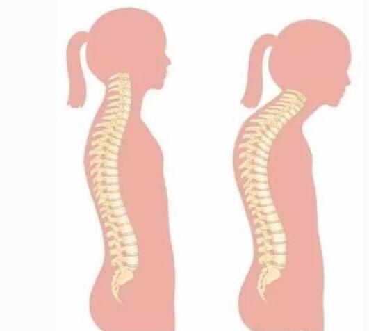 造成宝宝不良体型的原因