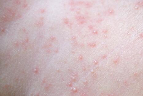 �������������������ӣ���������α�����֣�